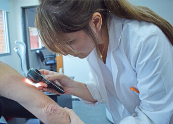 Con gran concurrencia de pacientes, el HAC finaliza la campaña de prevención del cáncer de piel