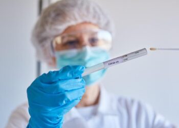 COVID-19: Entre las dos últimas semanas se registró una mínima variación en el conteo de casos