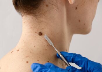 Formosa se suma durante toda esta semana a la Campaña Nacional de Prevención del Cáncer de Piel